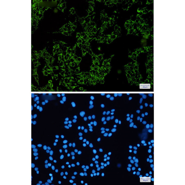 SGSM1 Antibody in Immunocytochemistry (ICC/IF)
