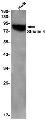 STRN4 Antibody in Western Blot (WB)