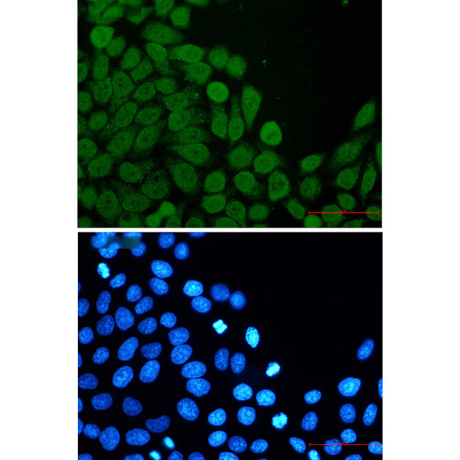 eIF4A3 Antibody in Immunocytochemistry (ICC/IF)