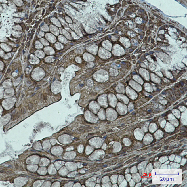 NDUFB11 Antibody in Immunohistochemistry (Paraffin) (IHC (P))