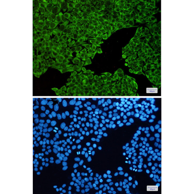 ENO3 Antibody in Immunocytochemistry (ICC/IF)