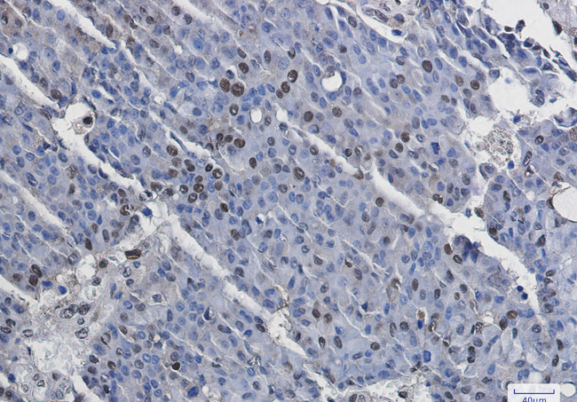 Phospho-MSK1 (Ser376) Antibody in Immunohistochemistry (Paraffin) (IHC (P))
