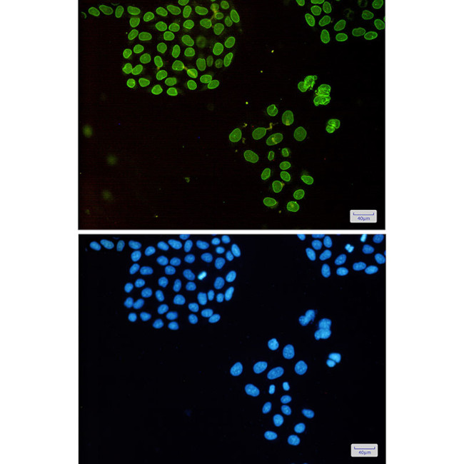 Emerin Antibody in Immunocytochemistry (ICC/IF)