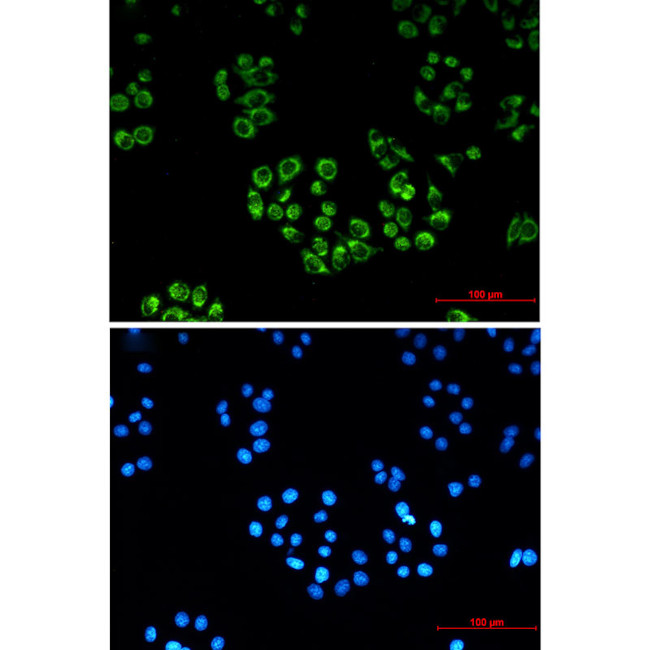 Fumarase Antibody in Immunocytochemistry (ICC/IF)