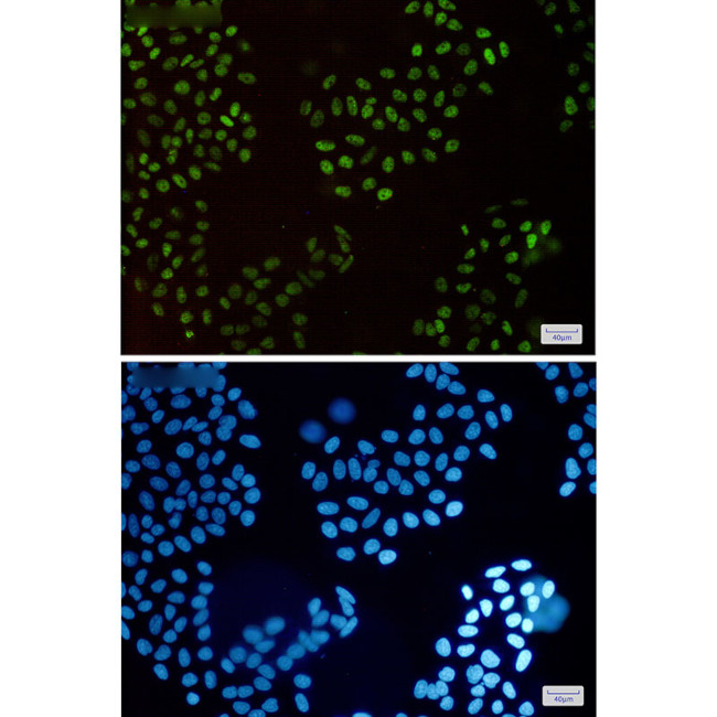 HLTF Antibody in Immunocytochemistry (ICC/IF)