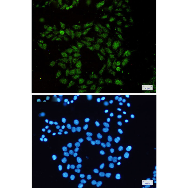 RAP1GAP Antibody in Immunocytochemistry (ICC/IF)