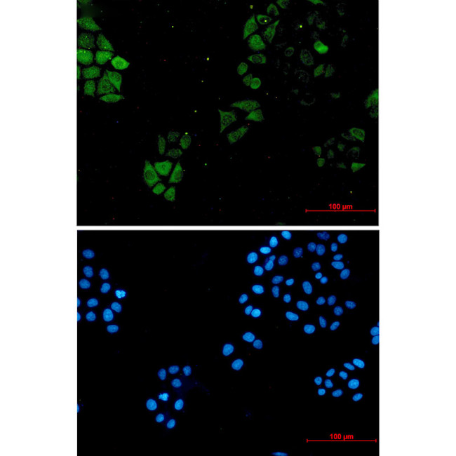 S100A4 Antibody in Immunocytochemistry (ICC/IF)