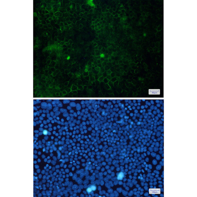 Cortactin Antibody in Immunocytochemistry (ICC/IF)