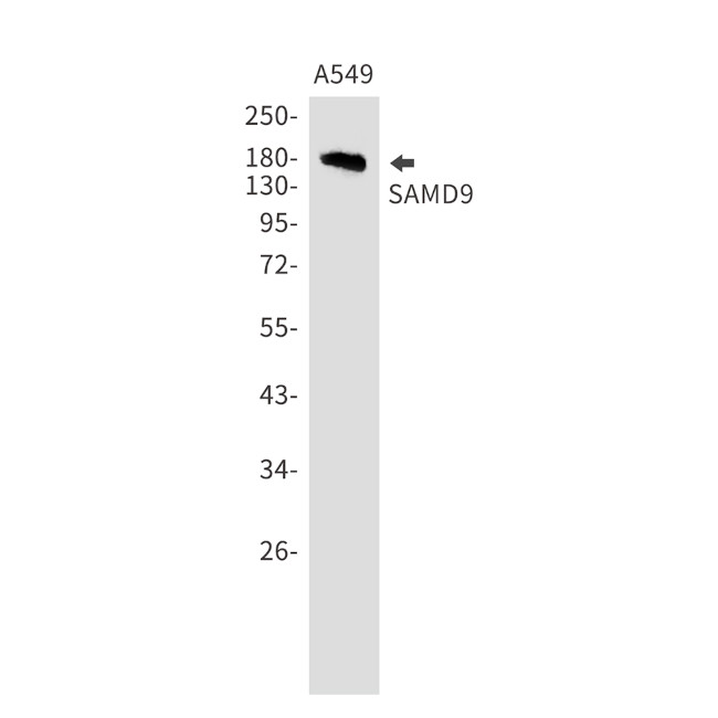 SAMD9 Antibody in Western Blot (WB)