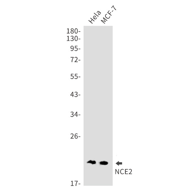 NCE2 Antibody in Western Blot (WB)