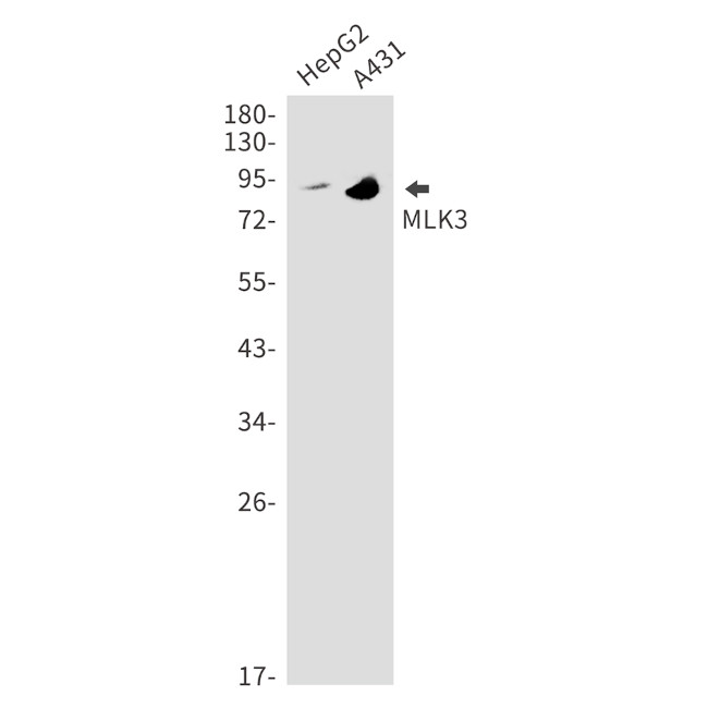 MLK3 Antibody in Western Blot (WB)