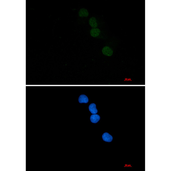 SAE1 Antibody in Immunocytochemistry (ICC/IF)