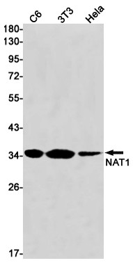 NAT1 Antibody in Western Blot (WB)