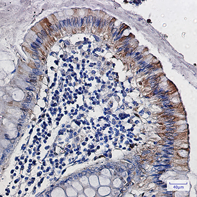 CDA Antibody in Immunohistochemistry (Paraffin) (IHC (P))