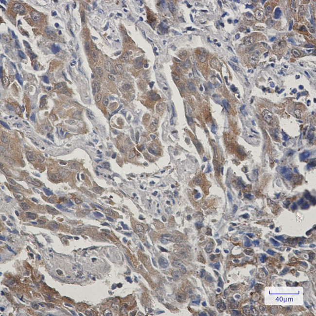 STIP1 Antibody in Immunohistochemistry (Paraffin) (IHC (P))