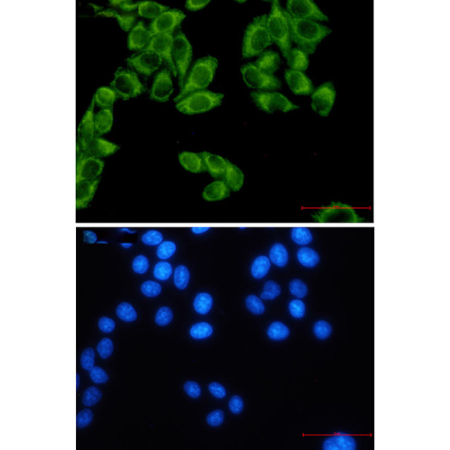 Fumarase Antibody in Immunocytochemistry (ICC/IF)