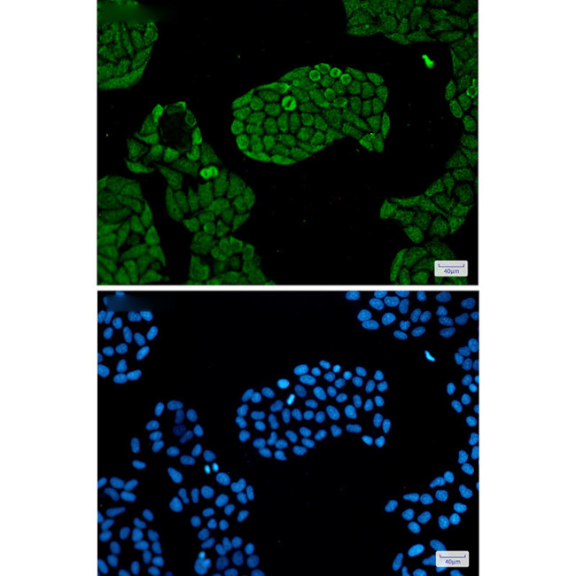 PSMC5 Antibody in Immunocytochemistry (ICC/IF)