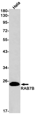 RAB7B Antibody in Western Blot (WB)