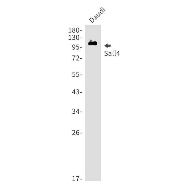 SALL4 Antibody in Western Blot (WB)