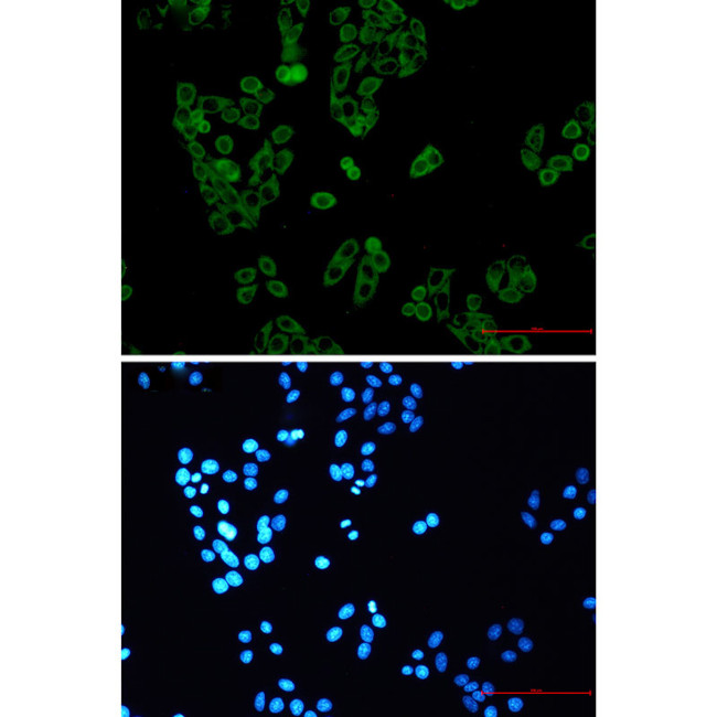 UPF1 Antibody in Immunocytochemistry (ICC/IF)