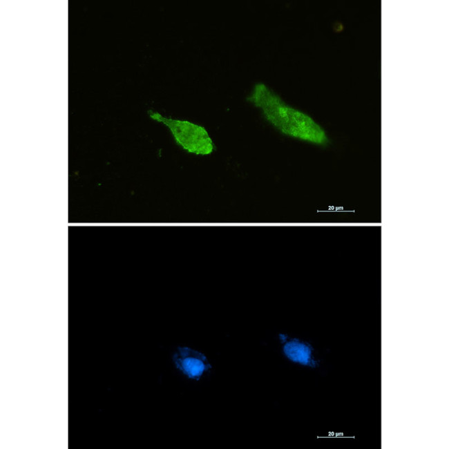 RAN Antibody in Immunocytochemistry (ICC/IF)