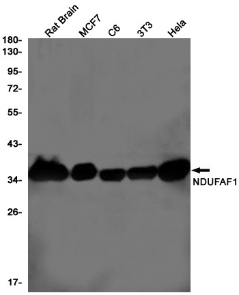 NDUFAF1 Antibody in Western Blot (WB)