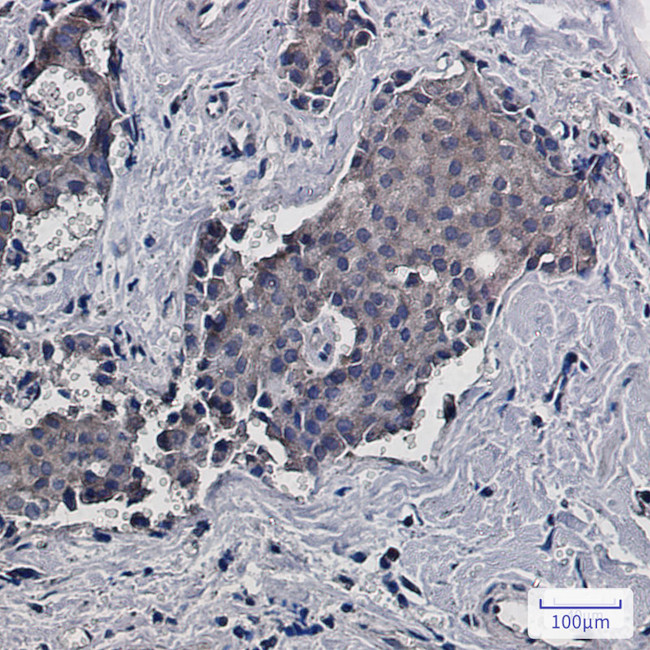 RACK1 Antibody in Immunohistochemistry (Paraffin) (IHC (P))