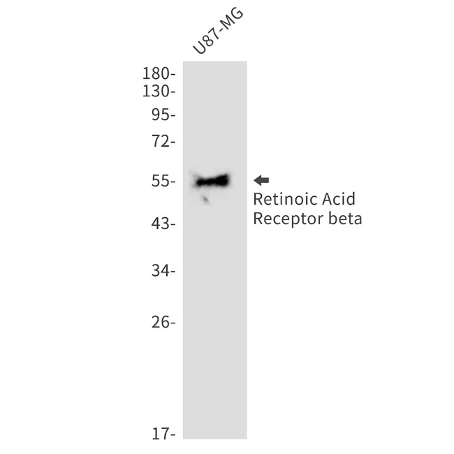 RARB Antibody in Western Blot (WB)