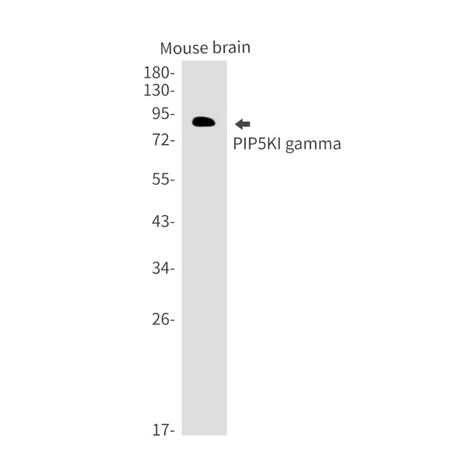 PIP5K1C Antibody in Western Blot (WB)