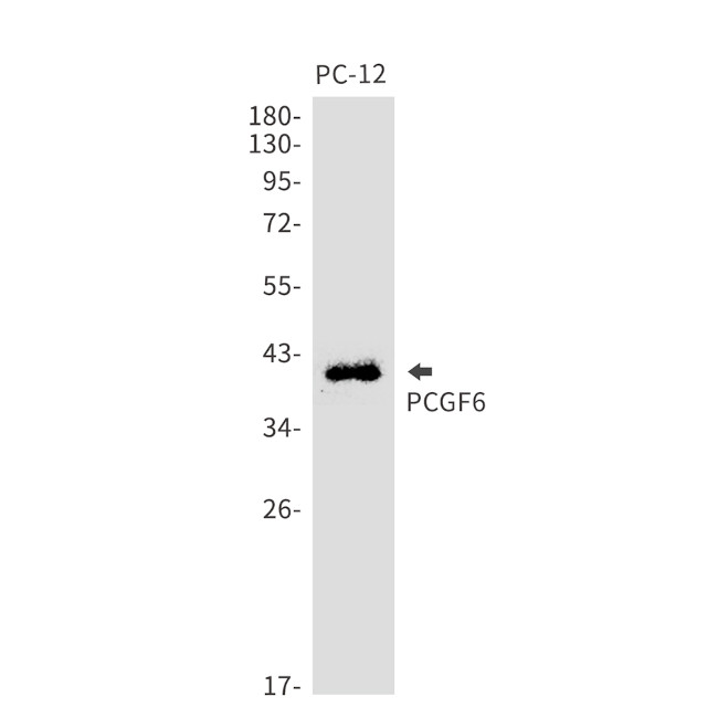 PCGF6 Antibody in Western Blot (WB)