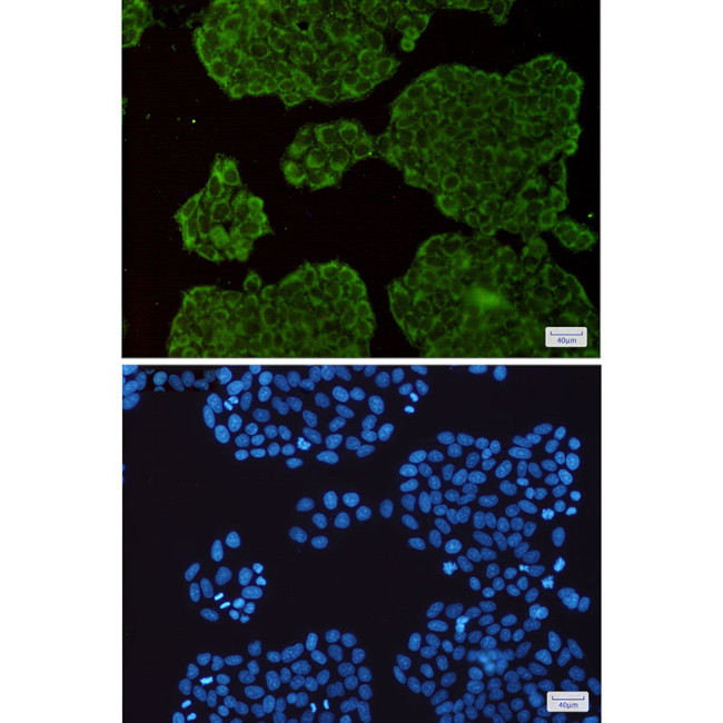 EXOC3 Antibody in Immunocytochemistry (ICC/IF)
