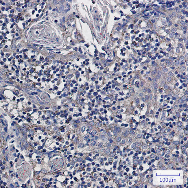 NDUFS6 Antibody in Immunohistochemistry (Paraffin) (IHC (P))