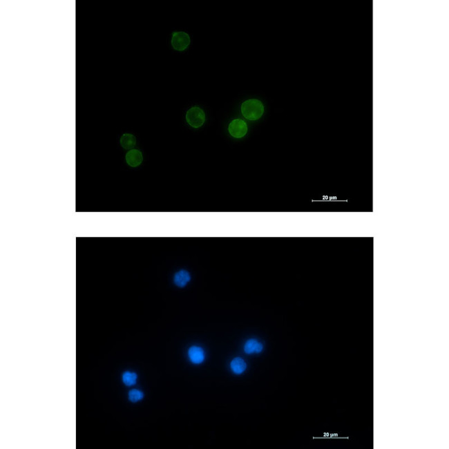 LCK Antibody in Immunocytochemistry (ICC/IF)