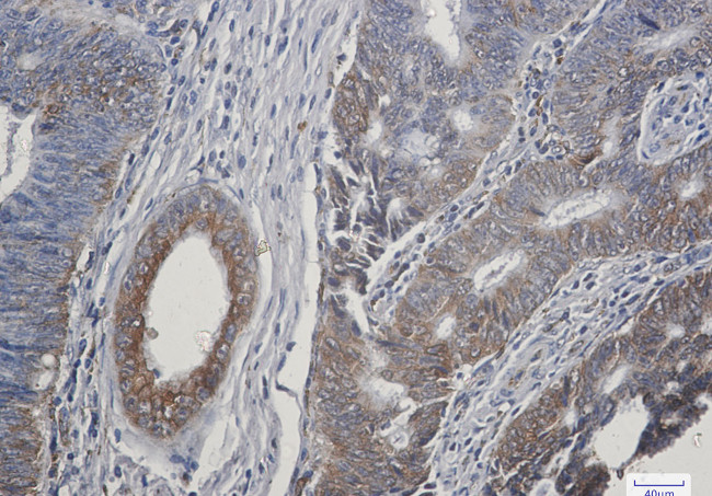 TGF alpha Antibody in Immunohistochemistry (Paraffin) (IHC (P))
