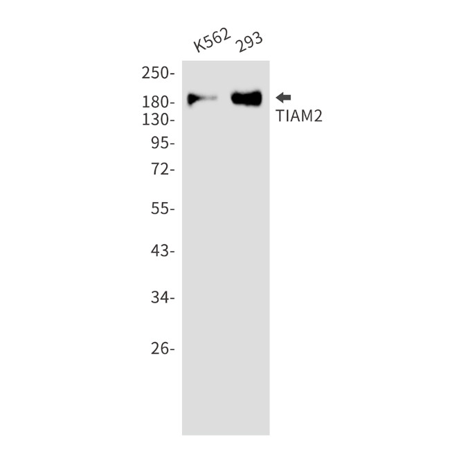 TIAM2 Antibody in Western Blot (WB)