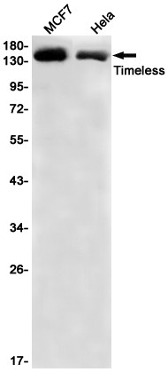 TIMELESS Antibody in Western Blot (WB)