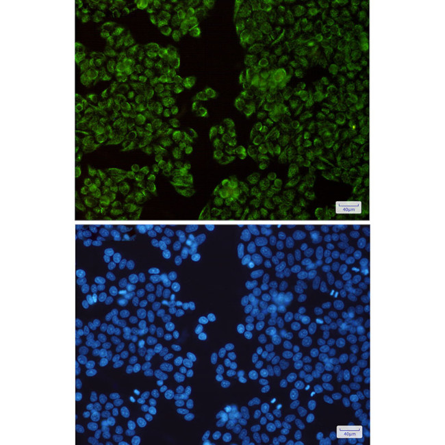 TIMM44 Antibody in Immunocytochemistry (ICC/IF)
