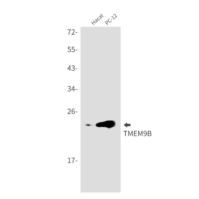TMEM9B Antibody in Western Blot (WB)