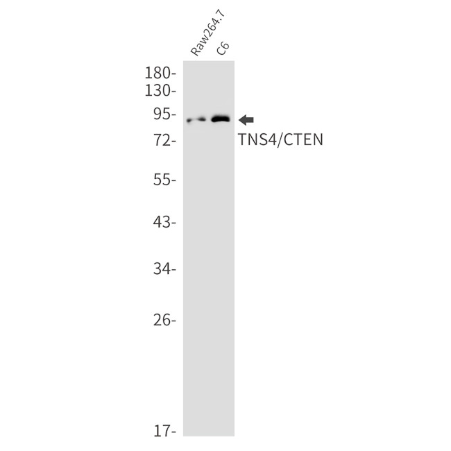 Tensin 4 Antibody in Western Blot (WB)
