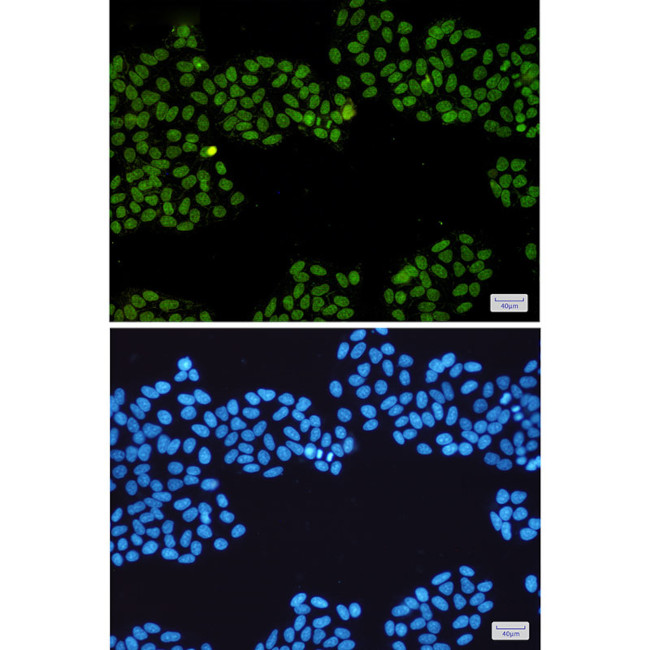 TOP1 Antibody in Immunocytochemistry (ICC/IF)