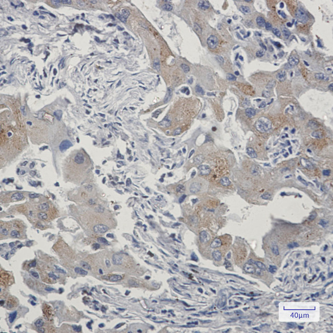 TAX1BP1 Antibody in Immunohistochemistry (Paraffin) (IHC (P))