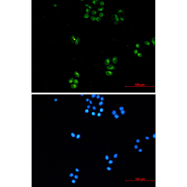 TRK fused gene Antibody in Immunocytochemistry (ICC/IF)