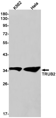 TRUB2 Antibody in Western Blot (WB)