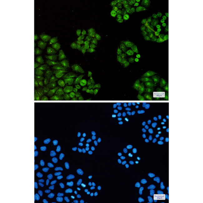 TTF2 Antibody in Immunocytochemistry (ICC/IF)