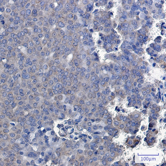 TXNDC9 Antibody in Immunohistochemistry (Paraffin) (IHC (P))