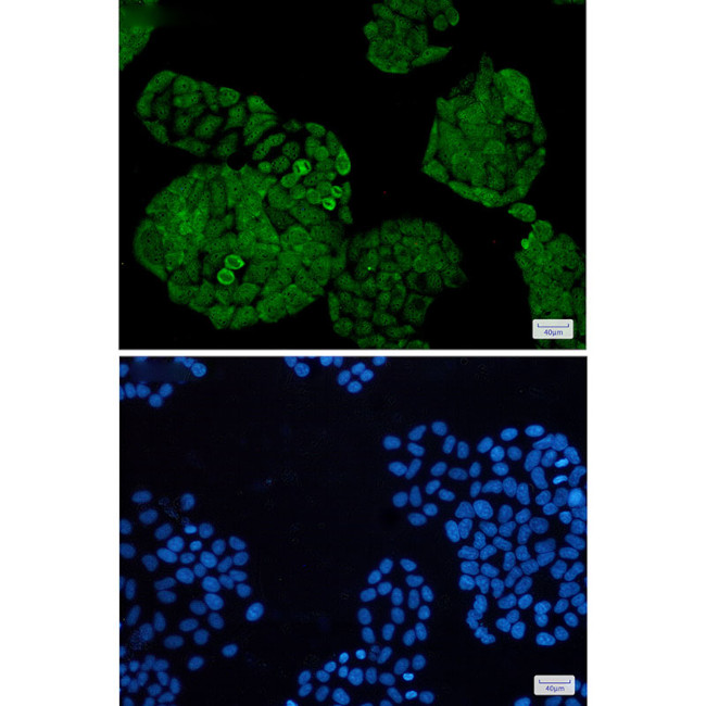 UCH37 Antibody in Immunocytochemistry (ICC/IF)