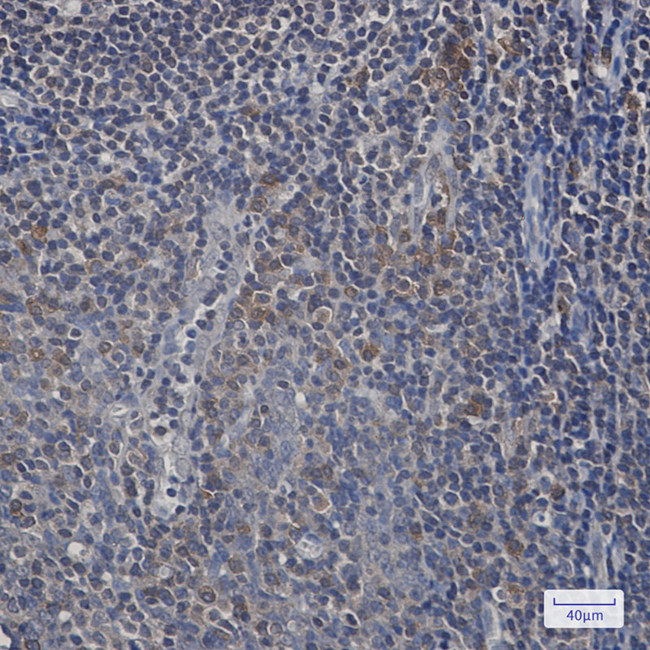 UFC1 Antibody in Immunohistochemistry (Paraffin) (IHC (P))