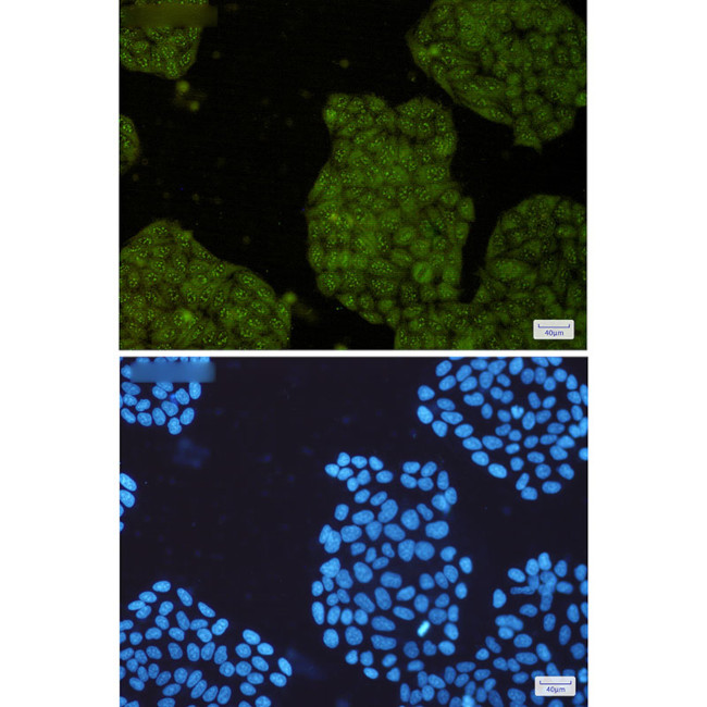 UFC1 Antibody in Immunocytochemistry (ICC/IF)