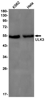 ULK3 Antibody in Western Blot (WB)
