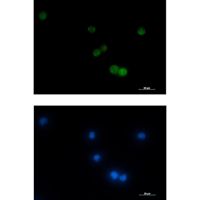 VAMP2 Antibody in Immunocytochemistry (ICC/IF)